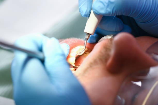 Best Walk-In Emergency Dental Services in Dana Point, CA